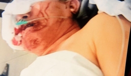 Con rể cùng đồng bọn chém gục Việt kiều Mỹ, trả thù cho bố vợ